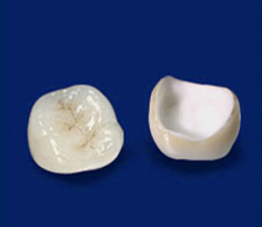 オールセラミック