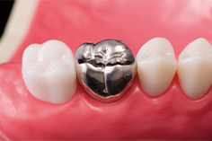 金銀パラジウム合金