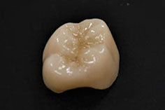 フルジルコニア